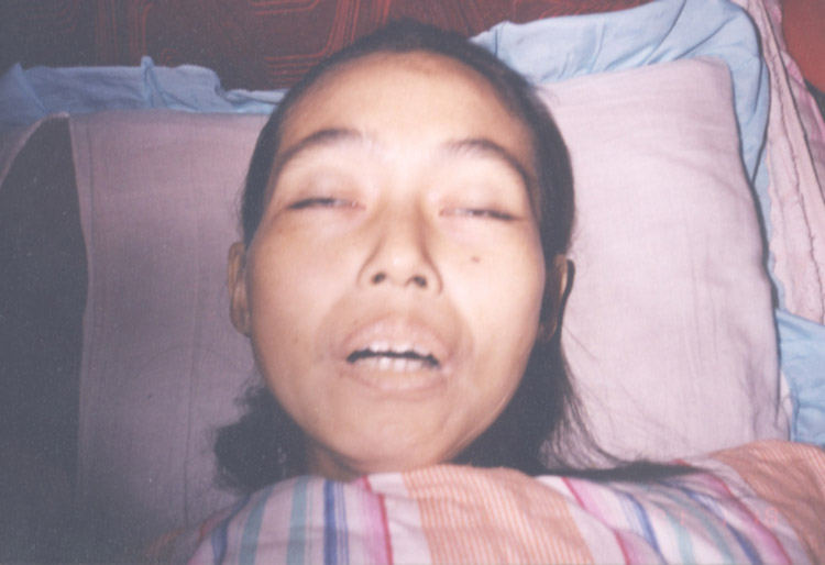 张桂琴被迫害致死照片 张桂琴被迫害致死照片